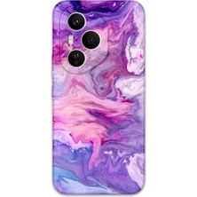 Gramaphone Honor 400 Pro Uyumlu Mermer Desenli Telefon Kılıfı + Ekran Koruyucu - 5813