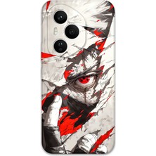Gramaphone Honor 400 Pro Uyumlu Anime Desenli Telefon Kılıfı + Ekran Koruyucu - 5876
