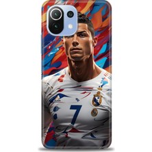 Rulet Xiaomi Mi 11 Lite Kılıf Hd Baskılı Kılıf + Seramik Tam Kaplayan Ekran Koruyucu 6