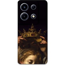 Gramaphone Infinix Note 30 Vıp Uyumlu Retro Desenli Telefon Kılıfı + Ekran Koruyucu - 5833