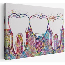 Renkli Dişler Implant Diş Hekimi Tablo Hd Dijital Baskı Yatay Kanvas Tablo 5768