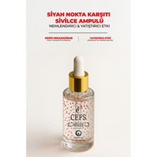 Akne & Sivilce Karşıtı Siyah Nokta Ampul Serum Cilt Bakım Serumu 50 ml