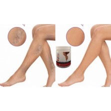 Varison Vücutkremi 200ML+50ML Ayakkremi