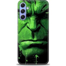 Mod Kılıf Samsung Galaxy A24 Hd Baskılı Kılıf + 9h Nano Tam Kaplayan Ekran Koruyucu 94