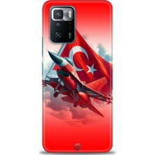 Mod Kılıf Xiaomi Poco X3 Gt Kılıf Hd Baskılı Kılıf + 9h Nano Tam Kaplayan Ekran Koruyucu 38
