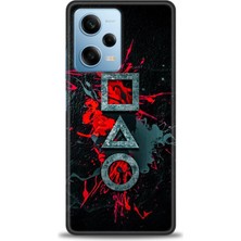 Mod Kılıf Xiaomi Redmi Note 12 Pro 5g Hd Baskılı Kılıf + 9h Nano Tam Kaplayan Ekran Koruyucu 281