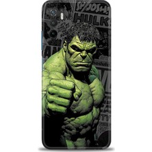 Mod Kılıf Xiaomi Poco M3 Pro Kılıf Hd Baskılı Kılıf + 9h Nano Tam Kaplayan Ekran Koruyucu 97