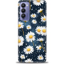 Mod Kılıf Tecno Camon 18P Kılıf Hd Baskılı Kılıf + 9h Nano Tam Kaplayan Ekran Koruyucu 132