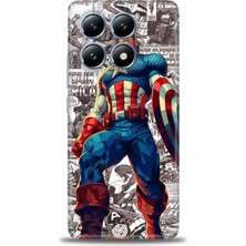 Mod Kılıf Xiaomi Mi 14T Kılıf Hd Baskılı Kılıf + 9h Nano Tam Kaplayan Ekran Koruyucu 91