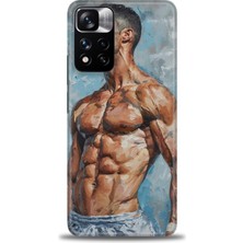 Mod Kılıf Xiaomi Redmi Note 11 Pro Plus Hd Baskılı Kılıf + 9h Nano Tam Kaplayan Ekran Koruyucu 4