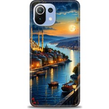 Mod Kılıf Xiaomi Mi 11 Lite Kılıf Hd Baskılı Kılıf + 9h Nano Tam Kaplayan Ekran Koruyucu 222