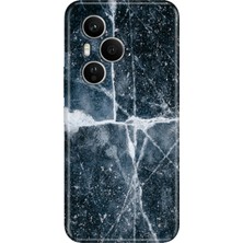 Nurdic Huawei Honor 400 Pro Kılıf Dekoratif Silikon Baskılı Kapak Bells Mermer