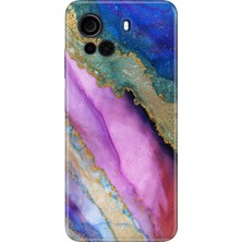 Nurdic Casper Via F30 Kılıf Kamera Korumalı Silikon Desenli Resimli Uv Kapak Sohomermer