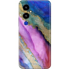 Nurdic Tecno Pova 4 Pro Kılıf Silikon Desenli Resimli Uv Kapak Sohomermer