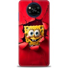 Mod Kılıf Xiaomi Poco X3 Nfc Kılıf Hd Baskılı Kılıf + 9h Nano Tam Kaplayan Ekran Koruyucu 458