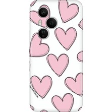 Nurdic Huawei Honor 400 Pro Kılıf Renkli Silikon Baskılı Tpu Pembe Çizgili Kalpler