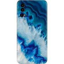 Nurdic General Mobile Gm 23 Uyumlu Kılıf Silikon Desenli Tam Koruma Resimli Koyu Ametist