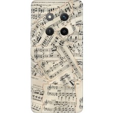 Nurdic Honor Magic 7 Lite Kılıf Dekoratif Silikon Baskılı Kapak Beste Nota