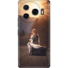 Nurdic Tecno Camon 30 Pro 5g Uyumlu Kılıf Desenli Baskılı Silikon Yalnız Çocuk