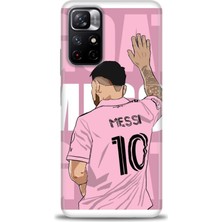 Mod Kılıf Xiaomi Redmi Note 11 Hd Baskılı Kılıf + 9h Nano Tam Kaplayan Ekran Koruyucu 16