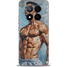 Mod Kılıf Xiaomi Redmi Note 14 Pro Plus Hd Baskılı Kılıf + 9h Nano Tam Kaplayan Ekran Koruyucu 4