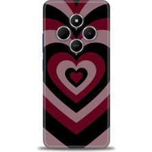 Mod Kılıf Xiaomi Redmi 14C 4g Kılıf Hd Baskılı Kılıf + 9h Nano Tam Kaplayan Ekran Koruyucu 191