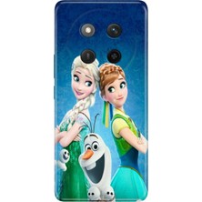 Nurdic Honor X60 Pro 5g Kılıf Tema Trendy Silikon Baskılı Elsa Anna Olaf