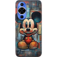 Nurdic Huawei Nova 12S Kılıf Desenli Tpu Cover Silikon Mickey Smile