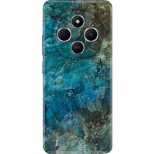 Nurdic Xiaomi Redmi A4 5g Kılıf Desenli Tpu Silikon Baskılı Mavi Mermer