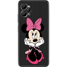 Nurdic Casper Via X30 Kılıf Resimli Baskılı Nano Silikon Minnie Karakter