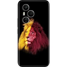 Nurdic Huawei Honor 400 Pro Kılıf Dekoratif Silikon Baskılı Kapak Gs5
