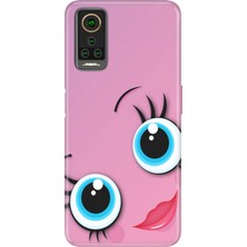 Nurdic General Mobile Gm 22 Pro Uyumlu Kılıf Silikon Desenli Tam Koruma Resimli Sevgidolu