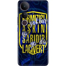 Nurdic Vivo V50 Lite 5g Kılıf Art Silikon Baskılı Tpu Aşkın Rengi Sarı Lacivert