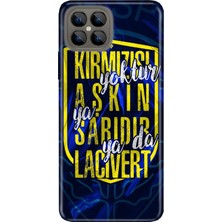 Nurdic Omix X600 Kılıf Silikon Tioserisi Desenli Resimli - Aşkın Rengi Sarı Lacivert