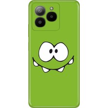 Nurdic Omix X7 Uyumlu Kılıf Resimli Baskılı Nano Silikon Şımarık