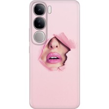 Nurdic Vivo V40 Lite Kılıf V40 Lite Desenli Tpu Silikon Saklı Aşk