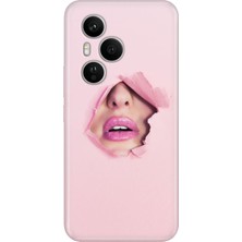 Nurdic Huawei Honor 400 Pro Kılıf Dekoratif Silikon Baskılı Kapak Saklı Aşk