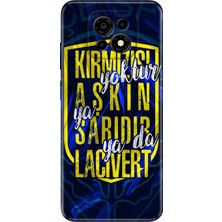 Nurdic Casper Via M30 Kılıf Telefon Kılıfı VIAM30 Baskılı Aşkın Rengi Sarı Lacivert