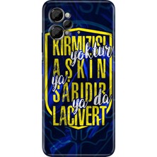 Nurdic Casper Via X30 Kılıf Resimli Baskılı Nano Silikon Aşkın Rengi Sarı Lacivert
