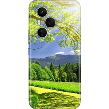 Nurdic Huawei Honor 400 Pro Kılıf Dekoratif Silikon Baskılı Kapak Mis Oksijen