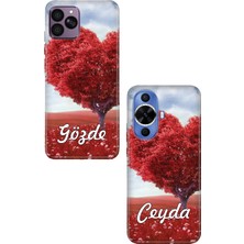 Nurdic Samsung Galaxy A53 A54 A55 A56 A72 A73 A74 Kılıf Kişiye Özel Isim Yazılı Silikon Ces-16