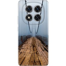 Nurdic Xiaomi Redmi Note 15 Pro Plus+ 5g Kılıf Dekoratif Silikon Baskılı Kapak Irlanda