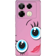 Nurdic Infinix Note 40 Pro 5g Kılıf Dekoratif Silikon Baskılı Kapak Sevgidolu