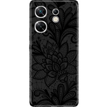 Nurdic Infinix Zero 30 4g Kılıf Resimli Baskılı Nano Silikon Mandala Gül