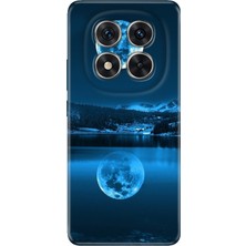 Nurdic Xiaomi Redmi Note 15 Pro Plus+ 5g Kılıf Renkli Silikon Baskılı Tpu Dolunay Deniz