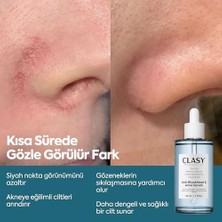 Mena Rise Clasycare Niacinamide Akne Karşıtı Serum – Gözenek Sıkılaştırıcı, Yağ Dengesi ve Cilt Aydınlatıcı Serum – Siyah Nokta ve Leke Karşıtı Yüz Serumu, 50 ml