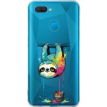 PrintiFy Oppo Ax7 ile Uyumlu Splash Tembel Hayvan Tasarımlı Slimfit Şeffaf Silikon Kılıf