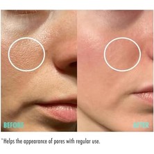 Mena Rise Maru.derm Gözenek Sıkılaştırıcı Cilt Serumu 30 ml