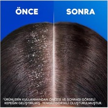 Mena Rise Head & Shoulders Ipeksi Yumuşaklık 2'si 1 Arada Kepek Karşıtı 330ML Şampuan