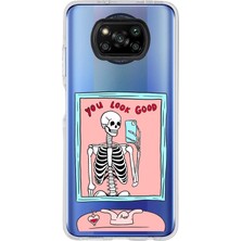 TechTree Poco X3 - X3 Pro Uyumlu You Look Good Iskelet Tasarımlı Baskılı Silikon Kılıf